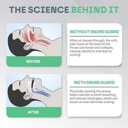 Anti Snore Mouth Guard Pro